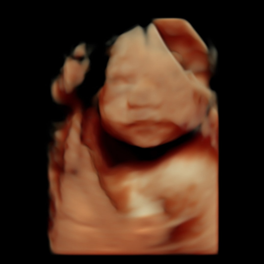 Photo shared by Brooke for their Babylist baby registry.