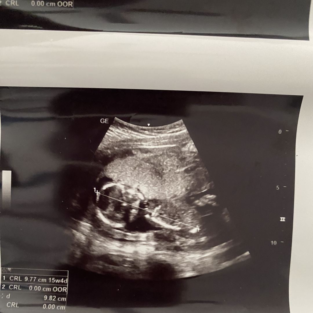 Photo shared by Brionne for their Babylist baby registry.