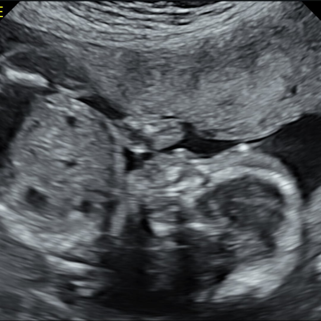 Photo shared by Sydney for their Babylist baby registry.