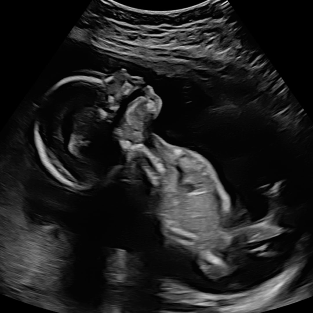 Photo shared by Daisy for their Babylist baby registry.