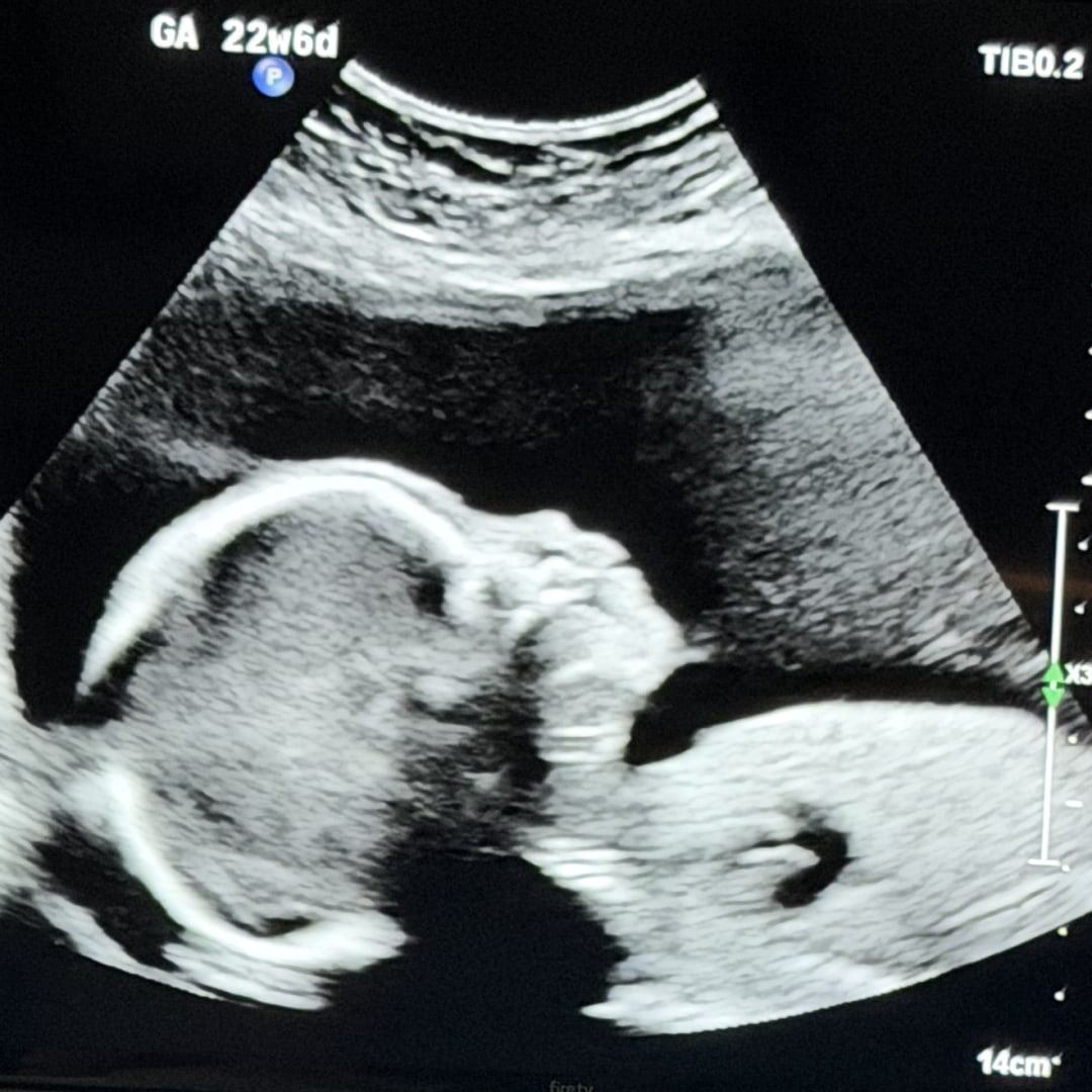 Photo shared by Alicia for their Babylist baby registry.