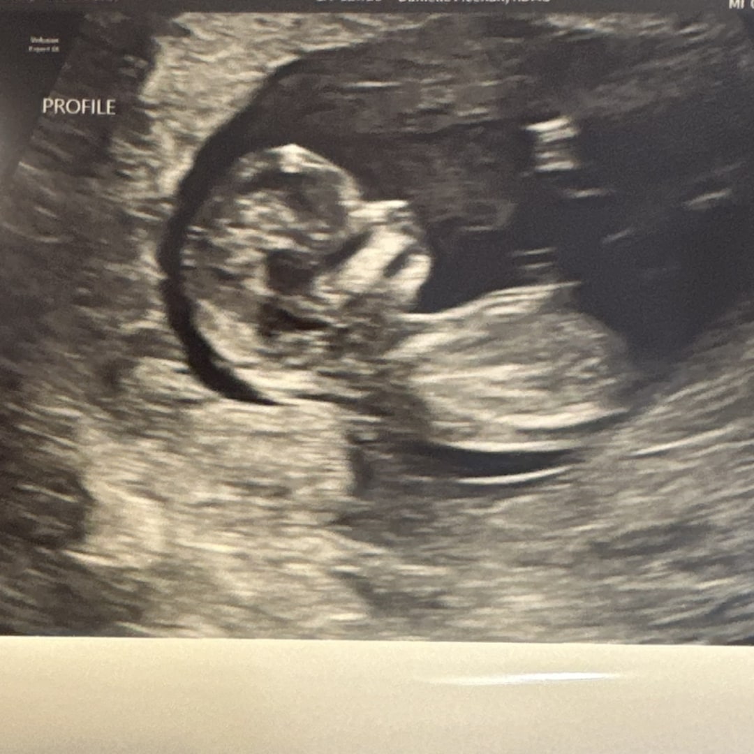 Photo shared by Ashley for their Babylist baby registry.