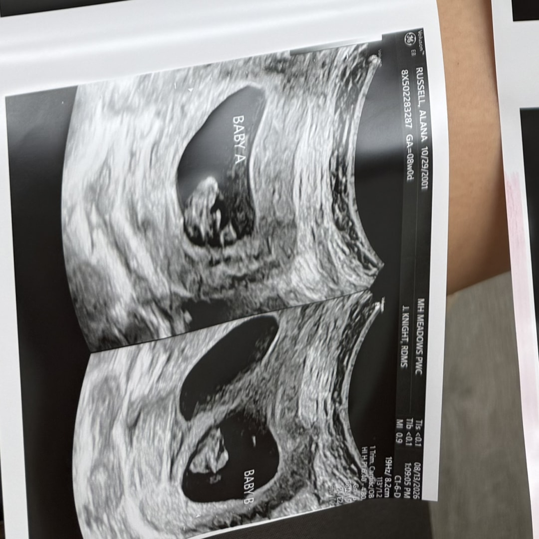 Photo shared by Alana for their Babylist baby registry.