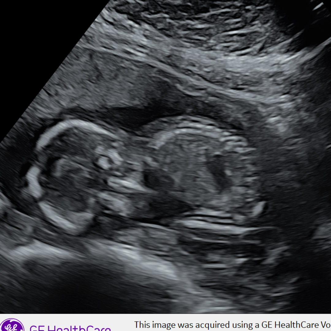 Photo shared by Yessica for their Babylist baby registry.