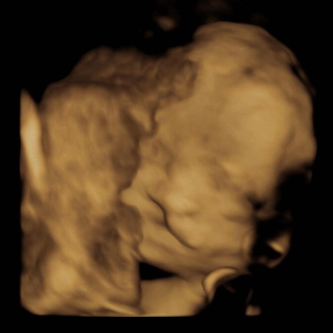 Photo shared by Malaney for their Babylist baby registry.