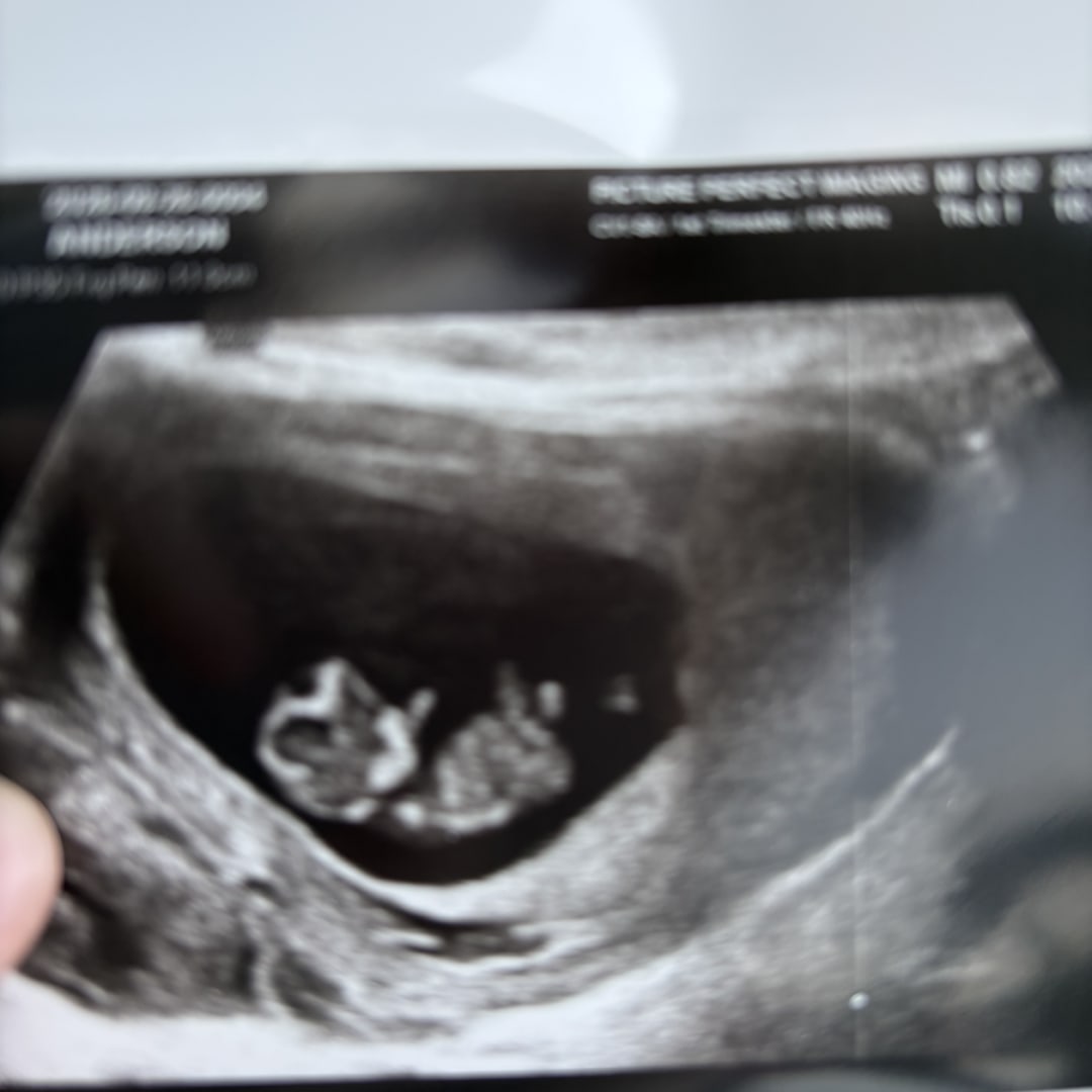 Photo shared by Madelyn for their Babylist baby registry.