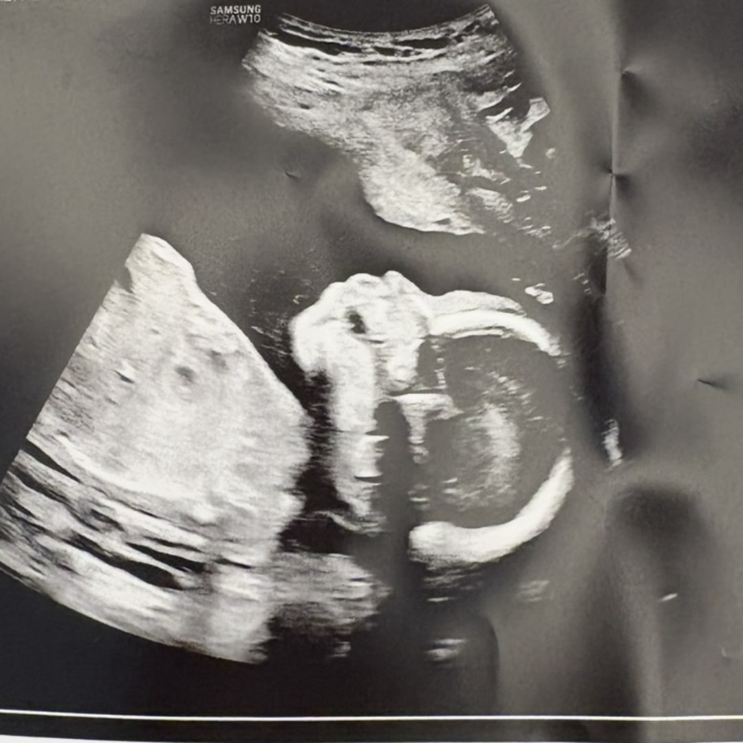 Photo shared by Jasmin for their Babylist baby registry.