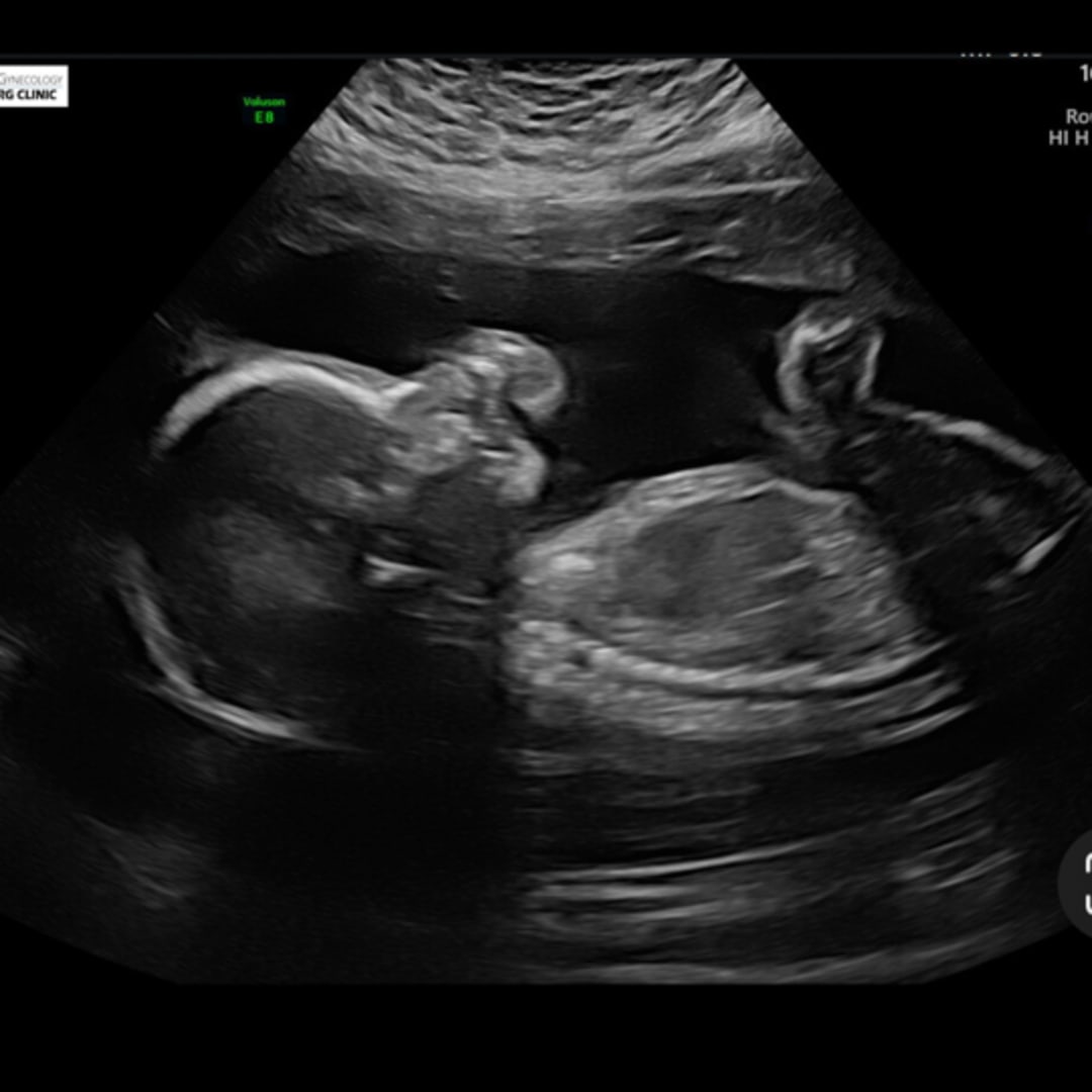 Photo shared by Kadence for their Babylist baby registry.