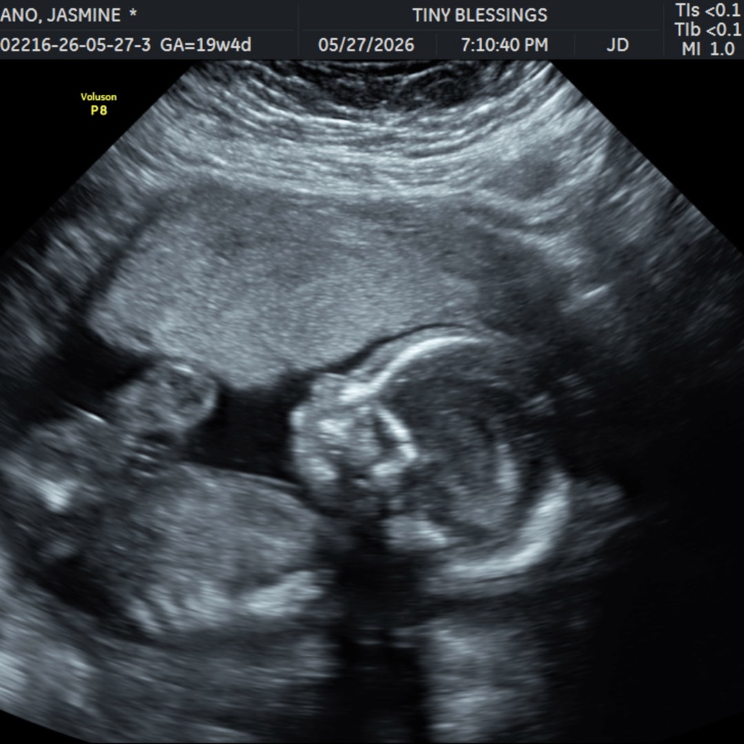 Photo shared by Jasmine for their Babylist baby registry.