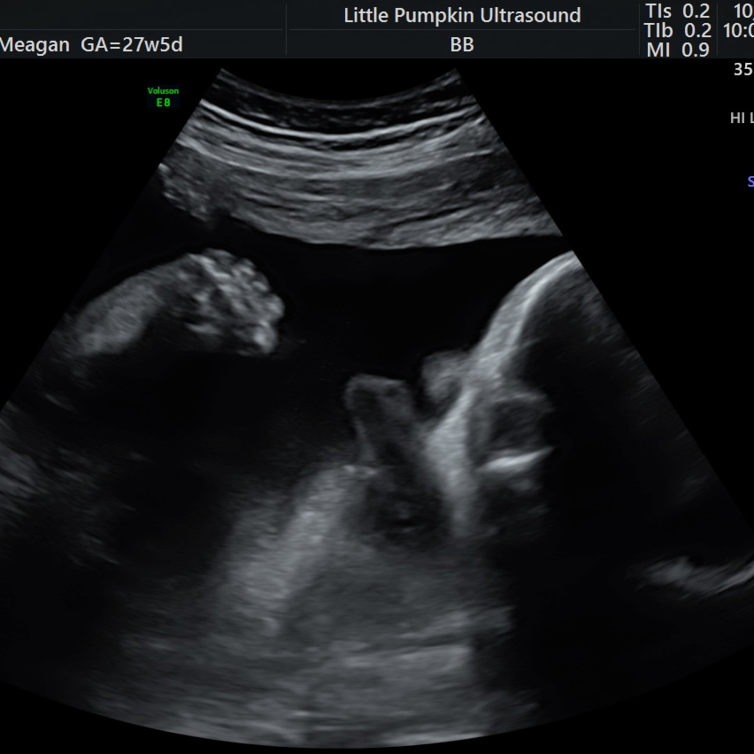Photo shared by Meagan for their Babylist baby registry.