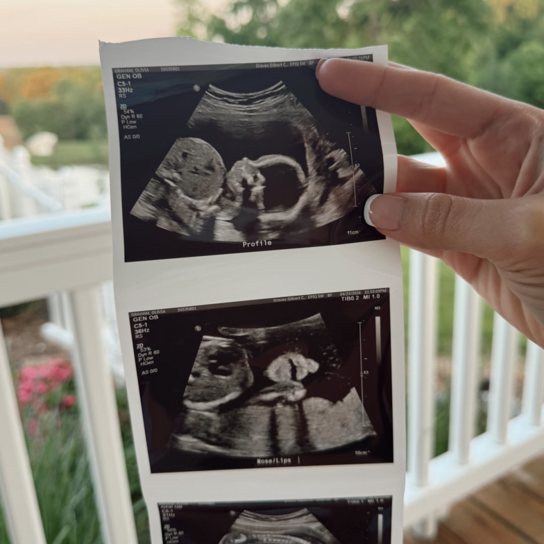 Photo shared by Olivia for their Babylist baby registry.