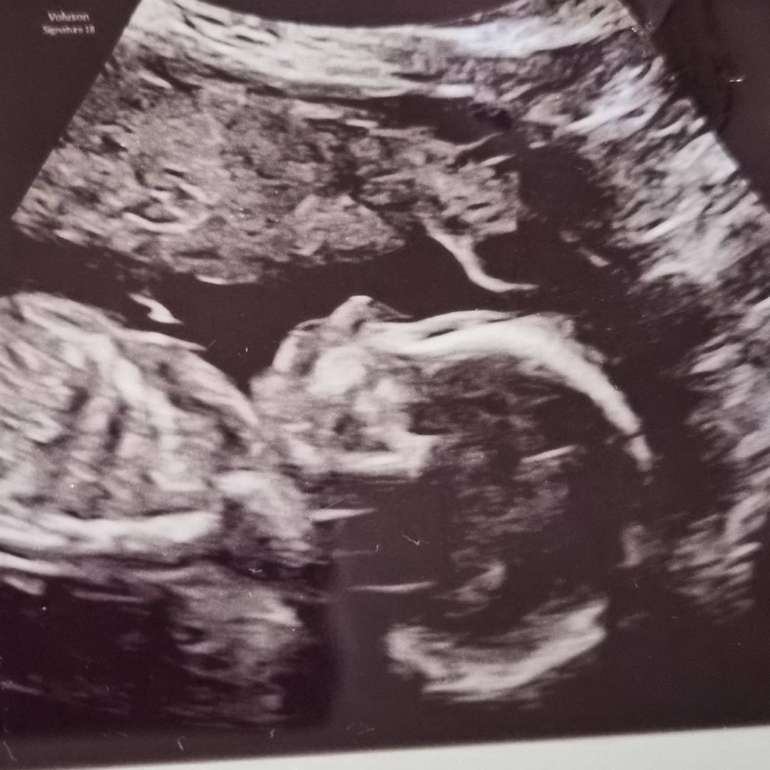 Photo shared by Emily for their Babylist baby registry.