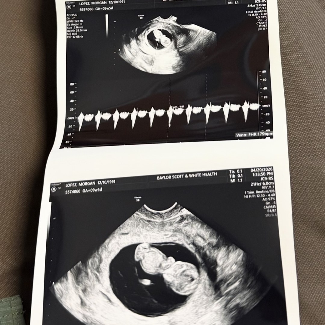 Photo shared by Morgan for their Babylist baby registry.