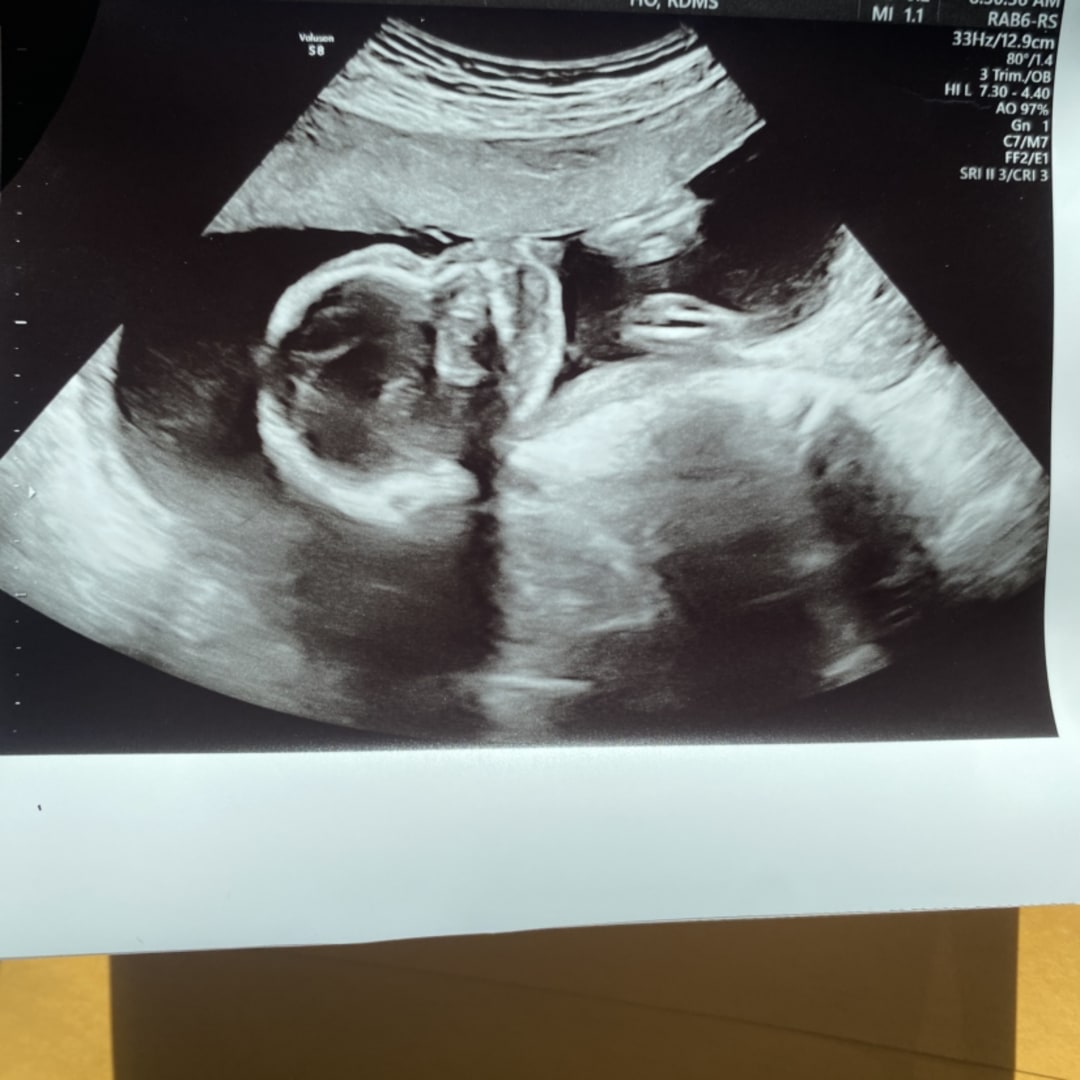 Photo shared by Bayley for their Babylist baby registry.