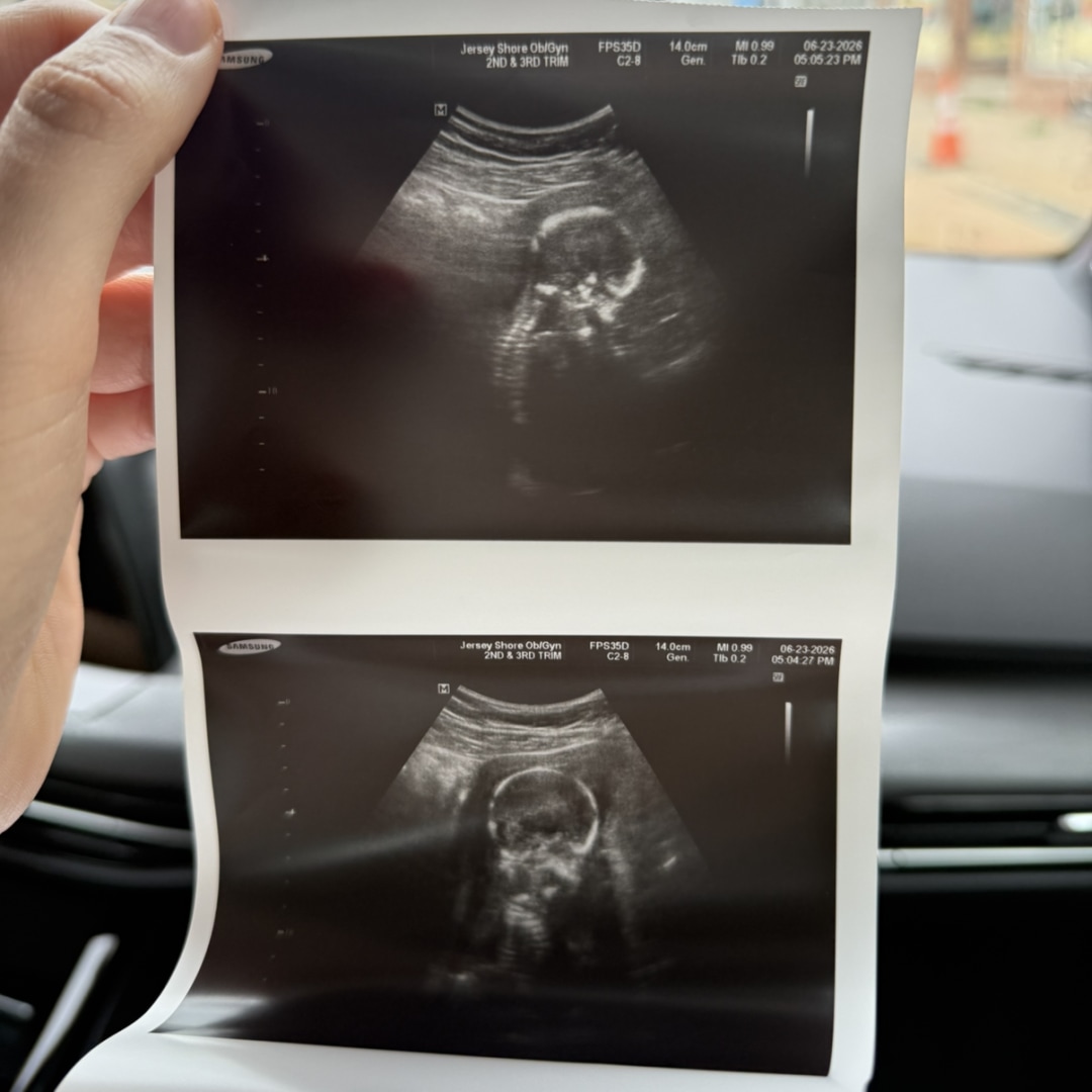 Photo shared by Emily for their Babylist baby registry.