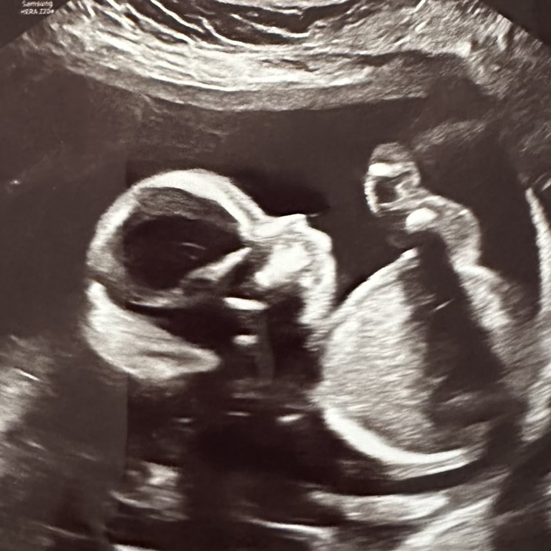 Photo shared by Casey for their Babylist baby registry.