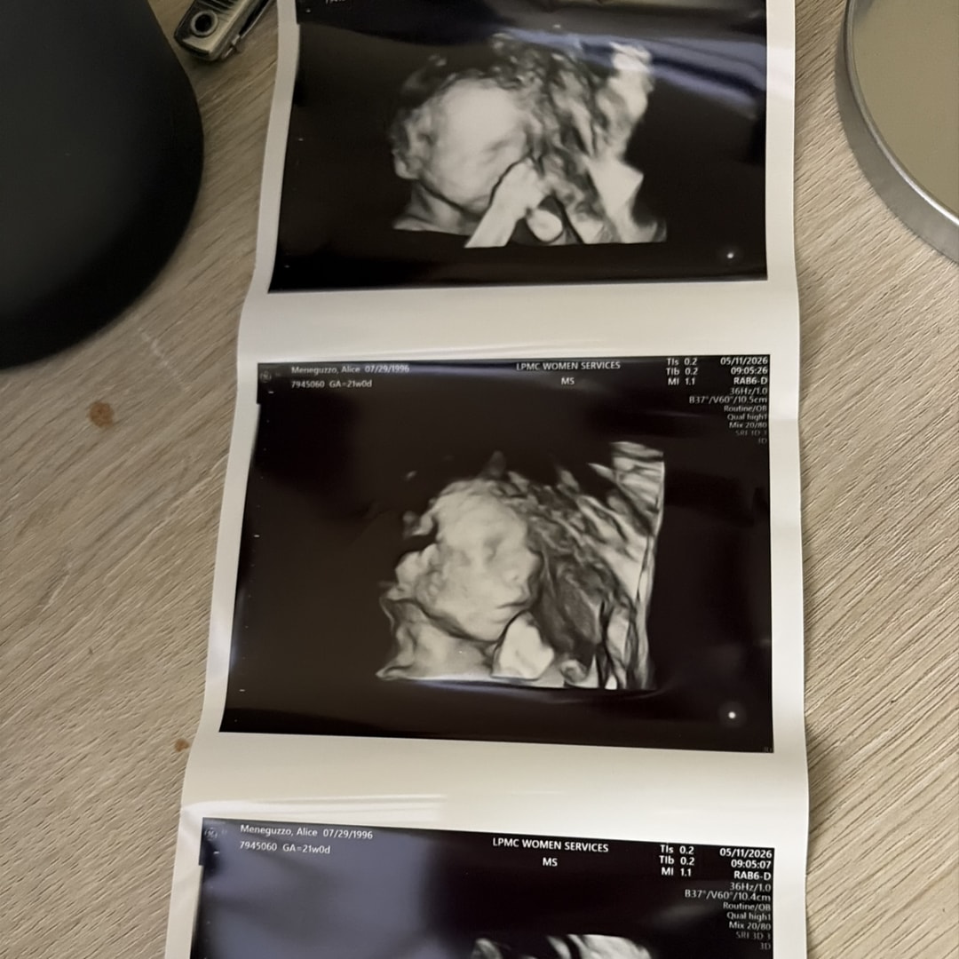 Photo shared by Alice for their Babylist baby registry.