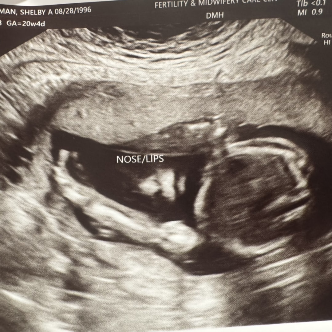 Photo shared by Shelby for their Babylist baby registry.