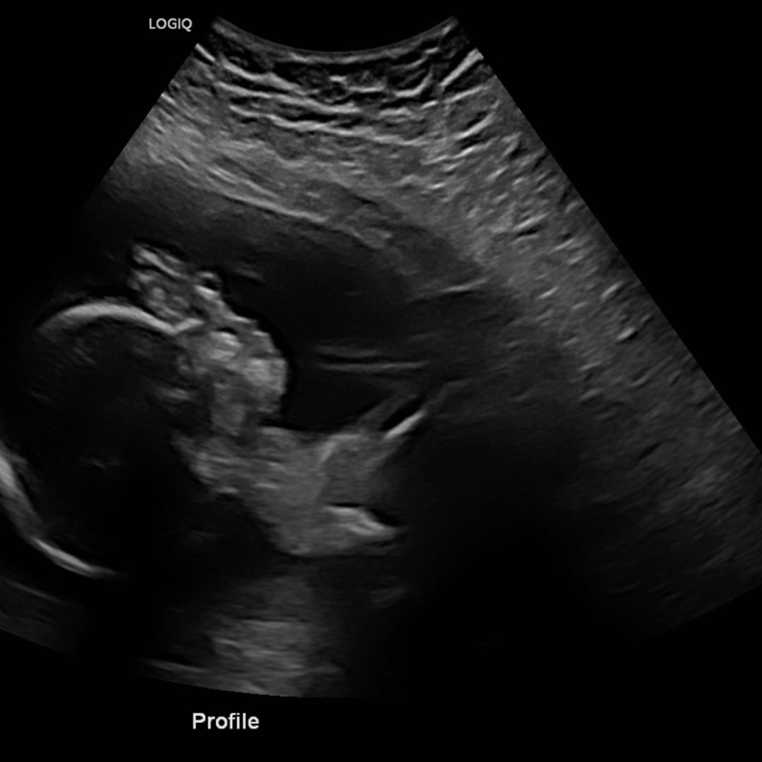 Photo shared by Abigail for their Babylist baby registry.