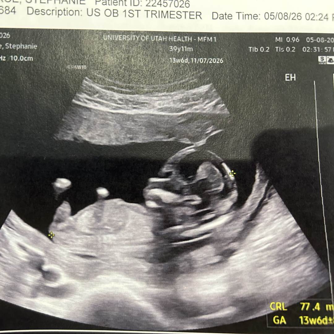 Photo shared by Stephanie for their Babylist baby registry.