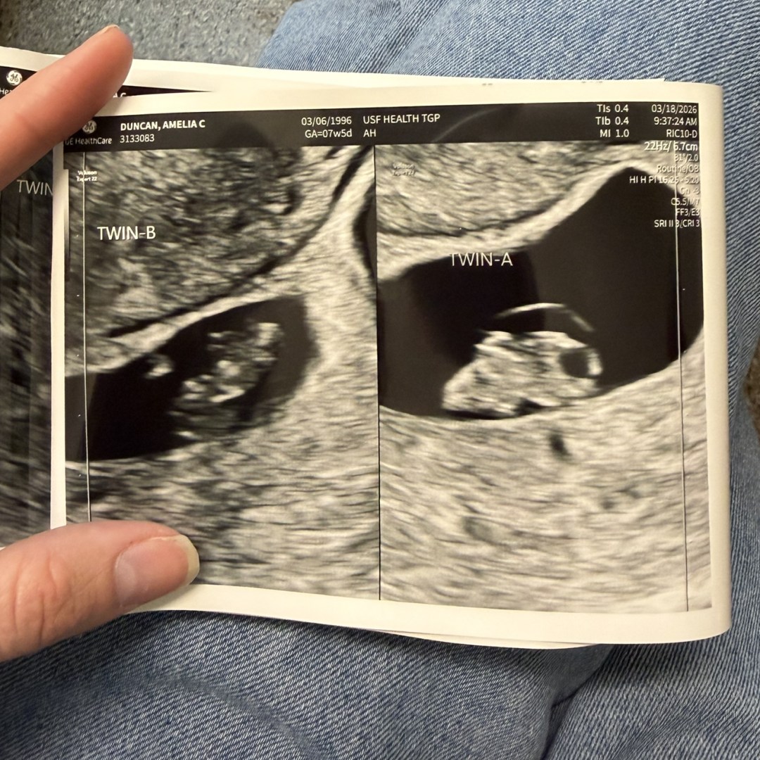 Photo shared by Amelia for their Babylist baby registry.