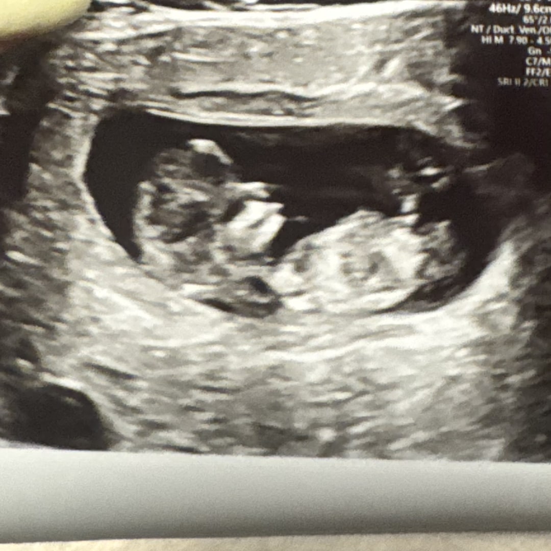 Photo shared by Maria for their Babylist baby registry.