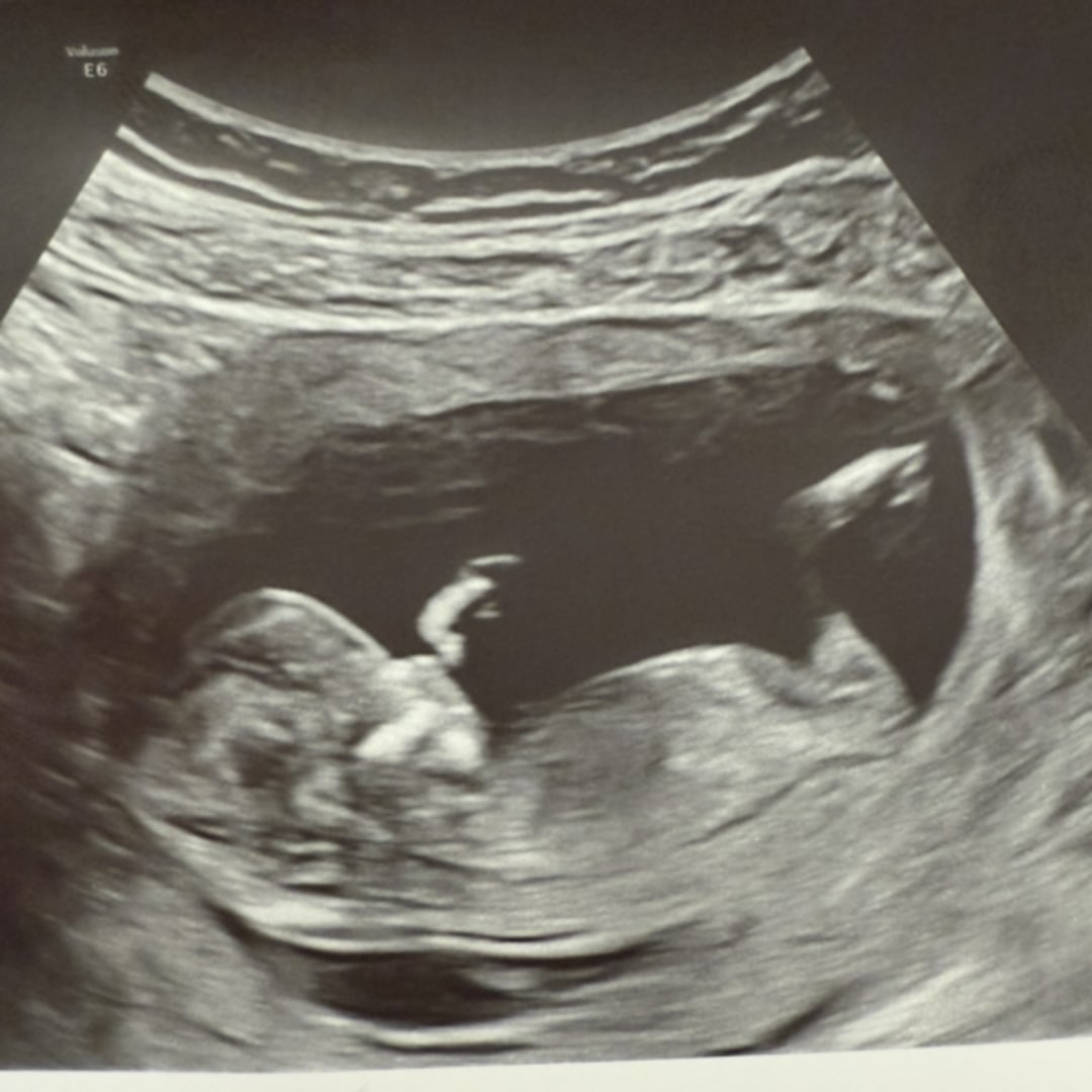 Photo shared by Elyssa for their Babylist baby registry.