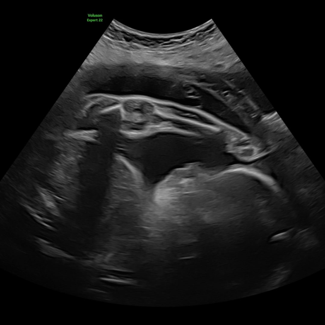 Photo shared by Stephanie for their Babylist baby registry.