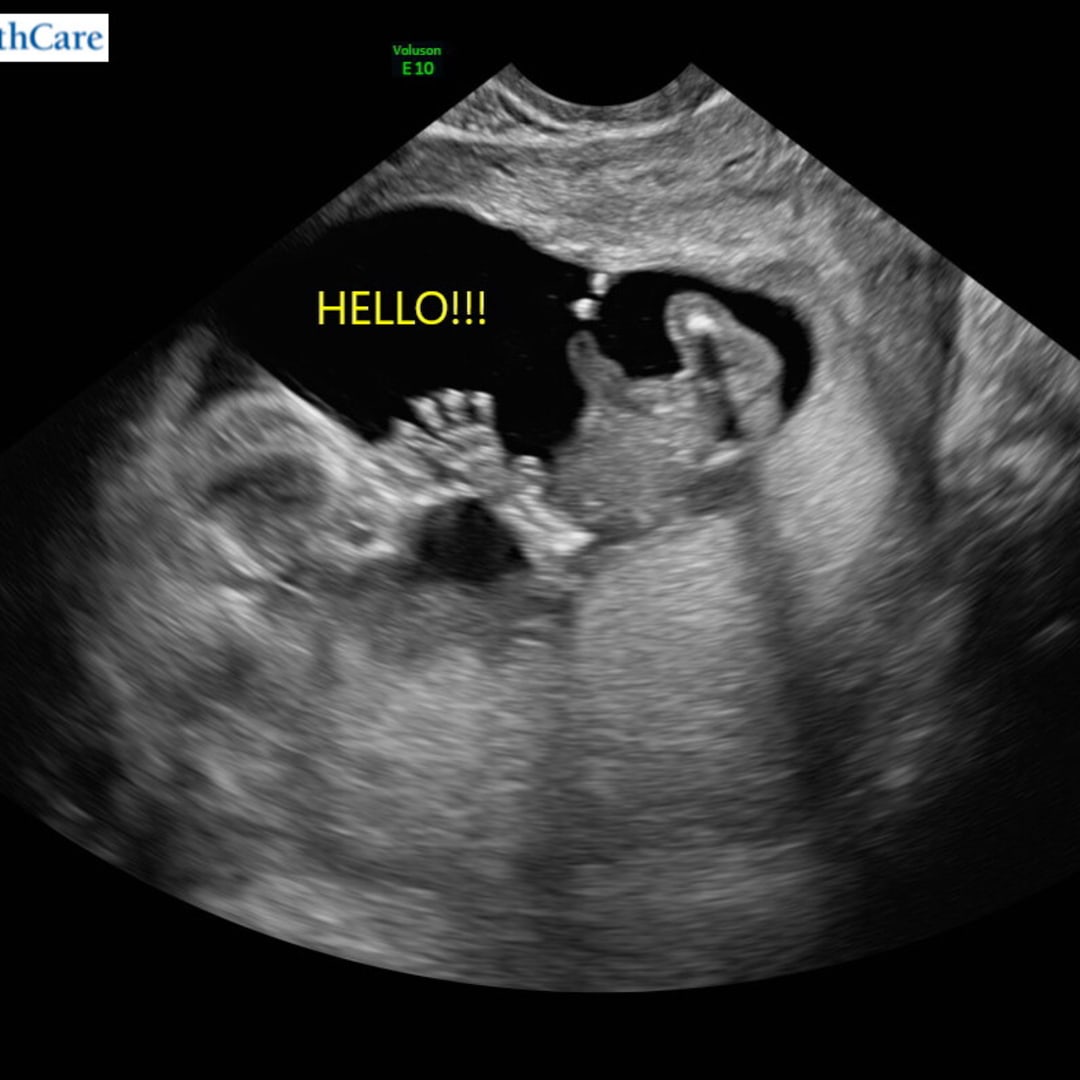 Photo shared by Lacey for their Babylist baby registry.