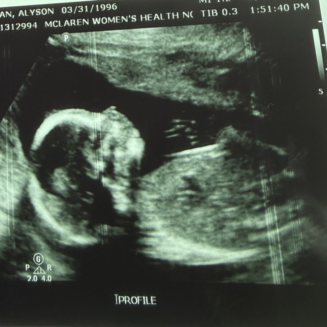 Photo shared by Alyson for their Babylist baby registry.
