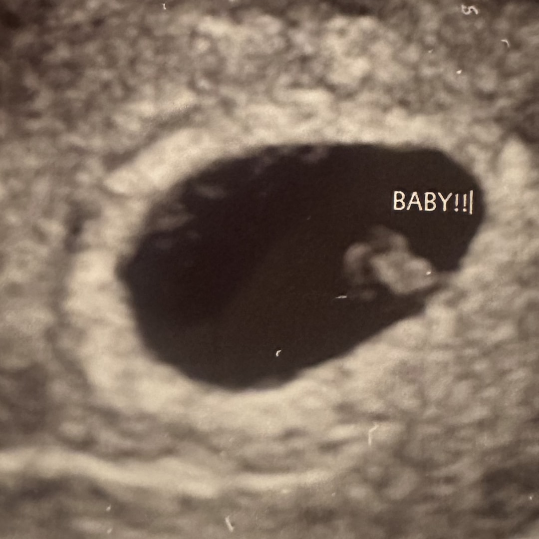 Photo shared by Melanie for their Babylist baby registry.