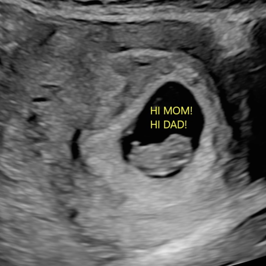 Photo shared by Amy for their Babylist baby registry.