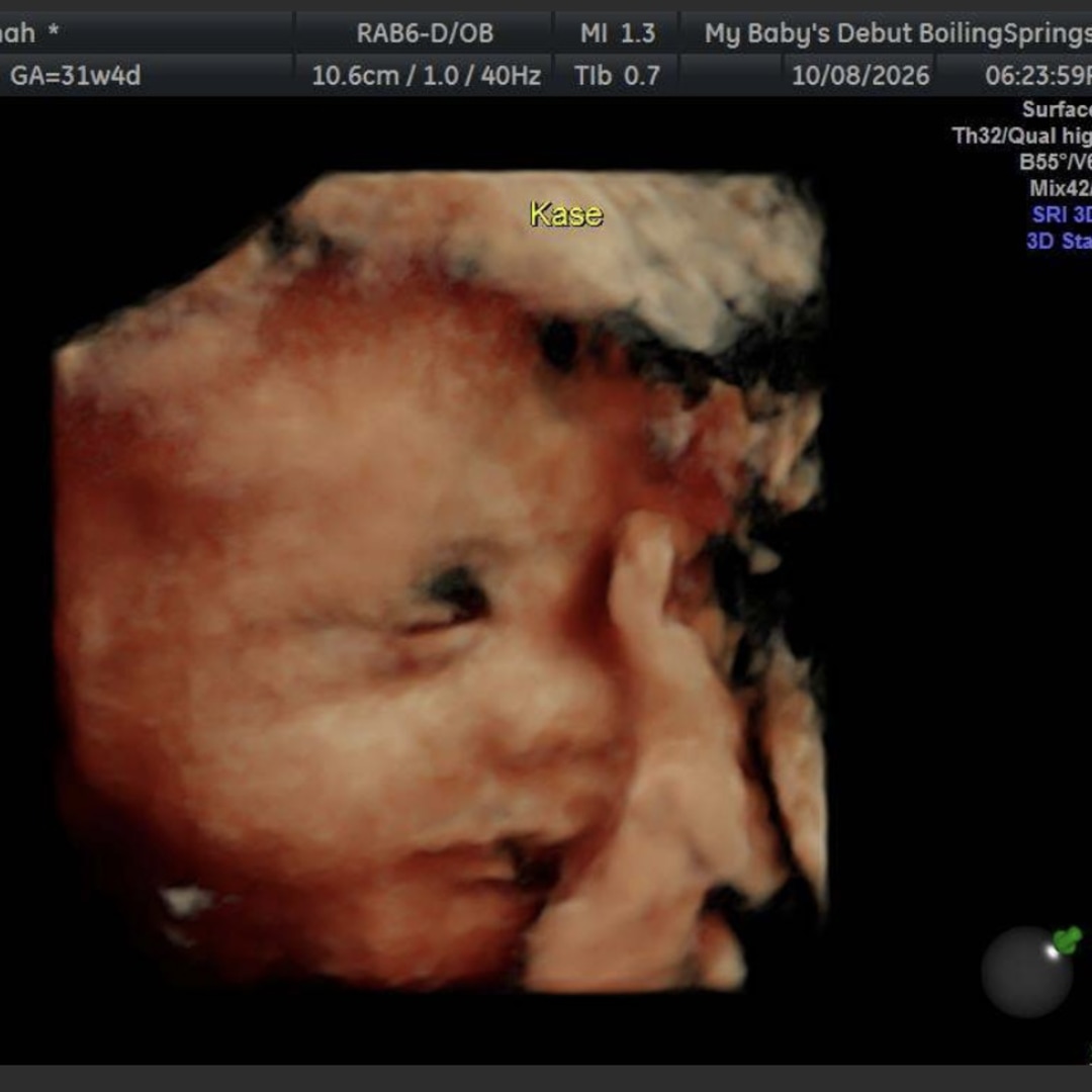 Photo shared by Savannah for their Babylist baby registry.