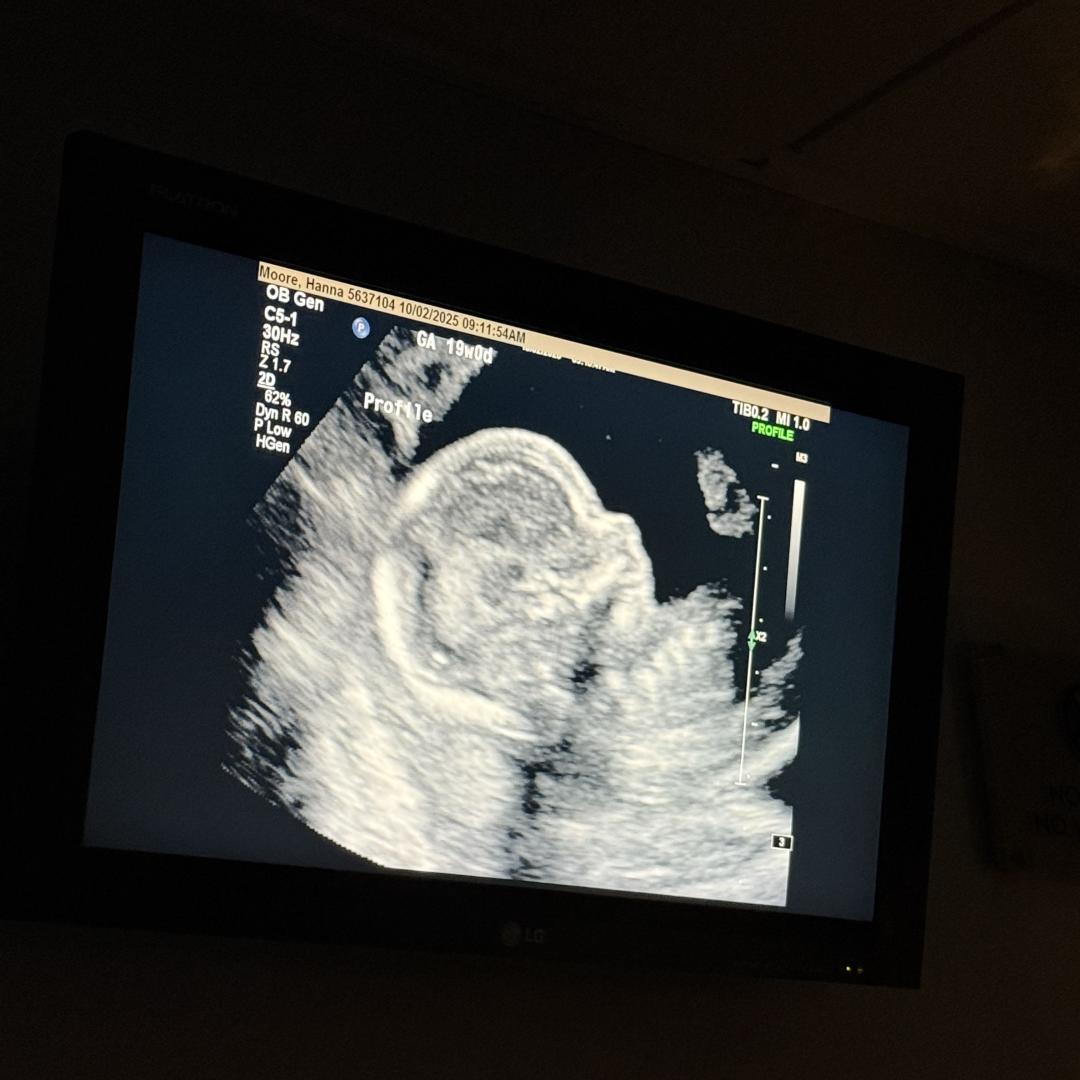 Photo shared by Hanna for their Babylist baby registry.