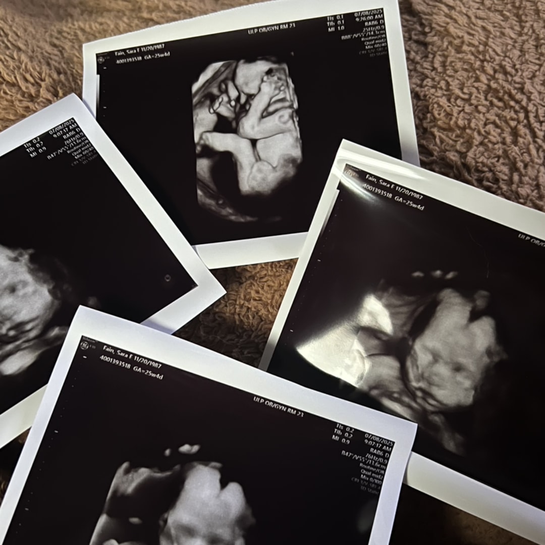 Photo shared by Sara for their Babylist baby registry.