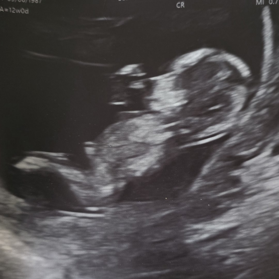 Photo shared by Sara for their Babylist baby registry.