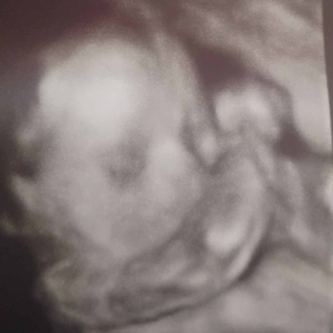 Photo shared by Magen for their Babylist baby registry.