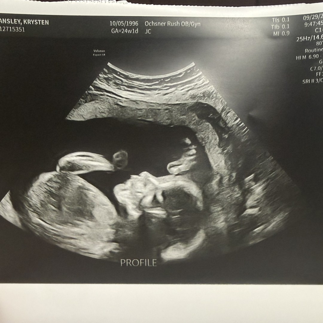 Photo shared by Krissy for their Babylist baby registry.