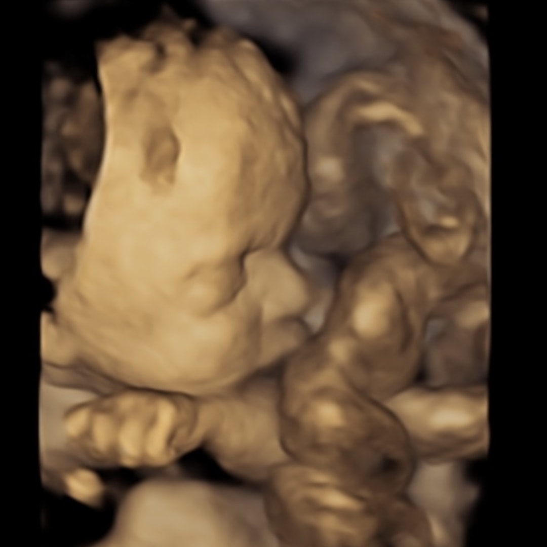 Photo shared by Mary for their Babylist baby registry.