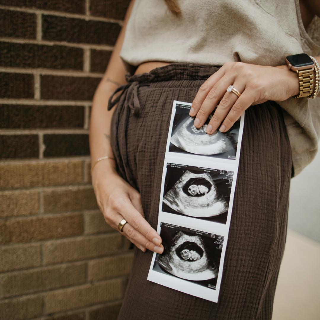 Photo shared by Ally for their Babylist baby registry.