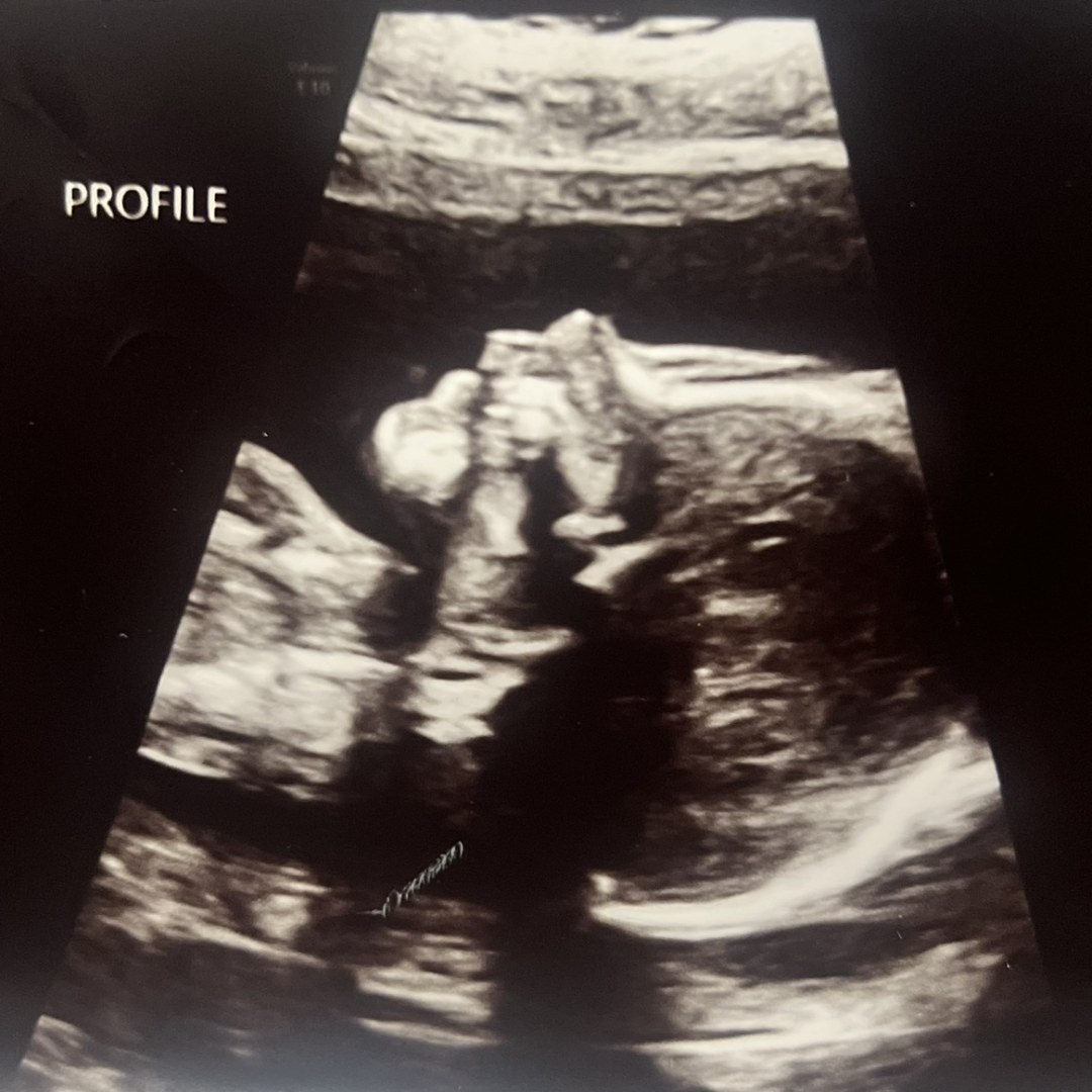 Photo shared by Angela for their Babylist baby registry.