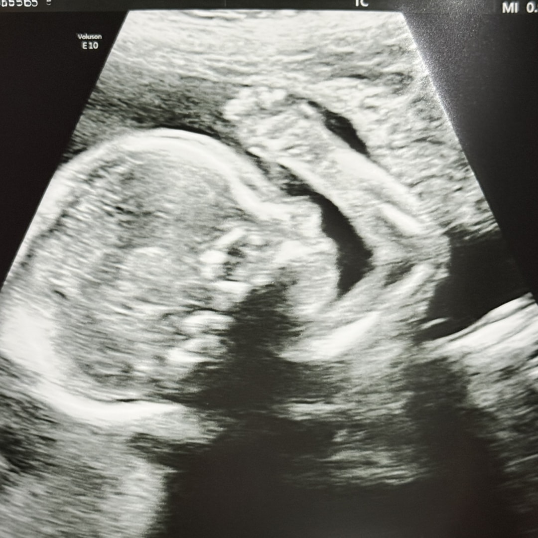 Photo shared by Alexandra for their Babylist baby registry.