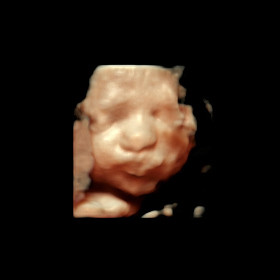 Photo shared by Madison for their Babylist baby registry.