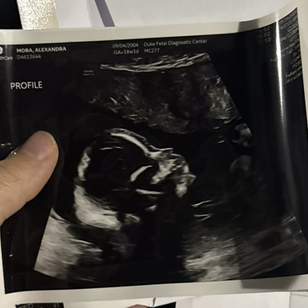 Photo shared by Alexandra for their Babylist baby registry.