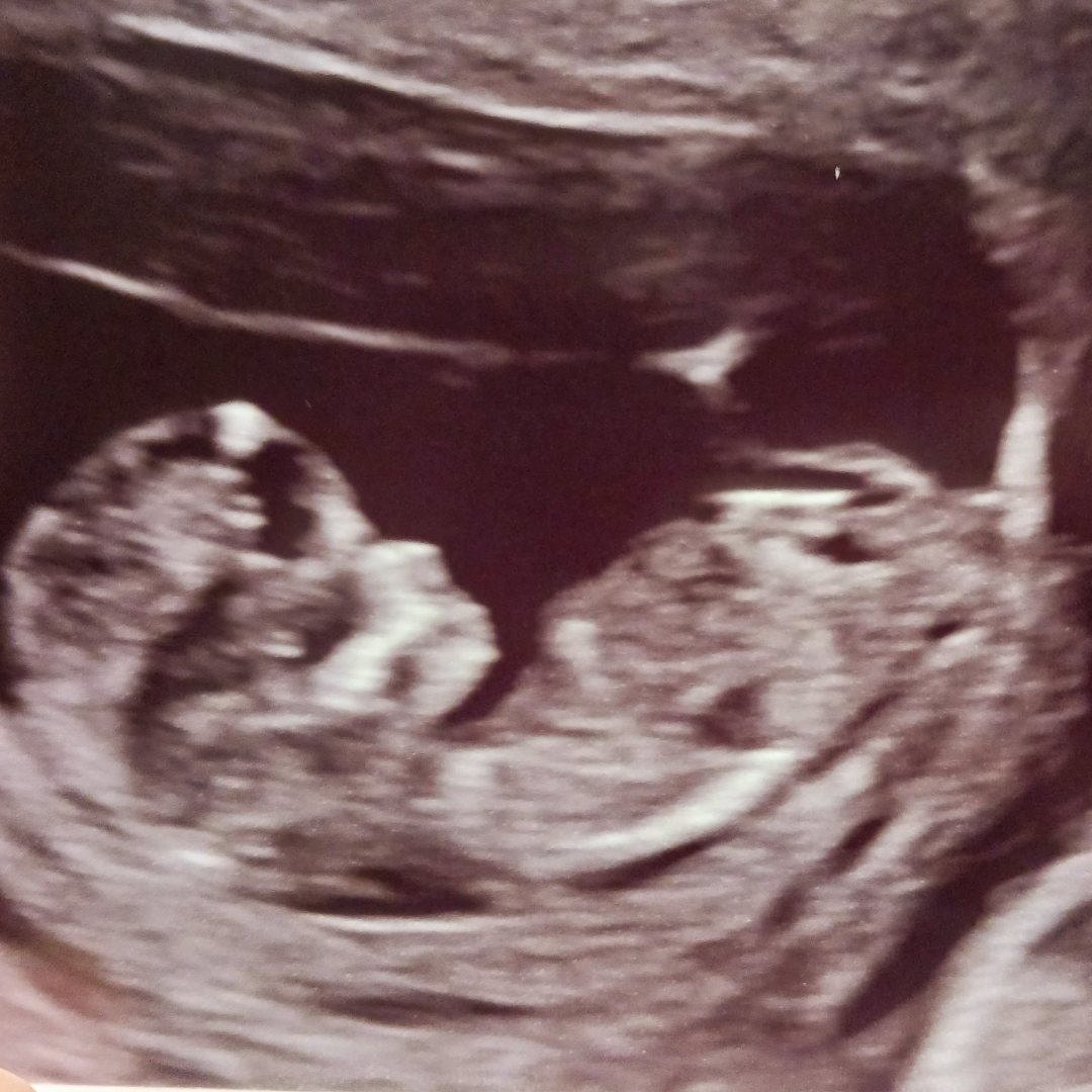 Photo shared by Annika for their Babylist baby registry.