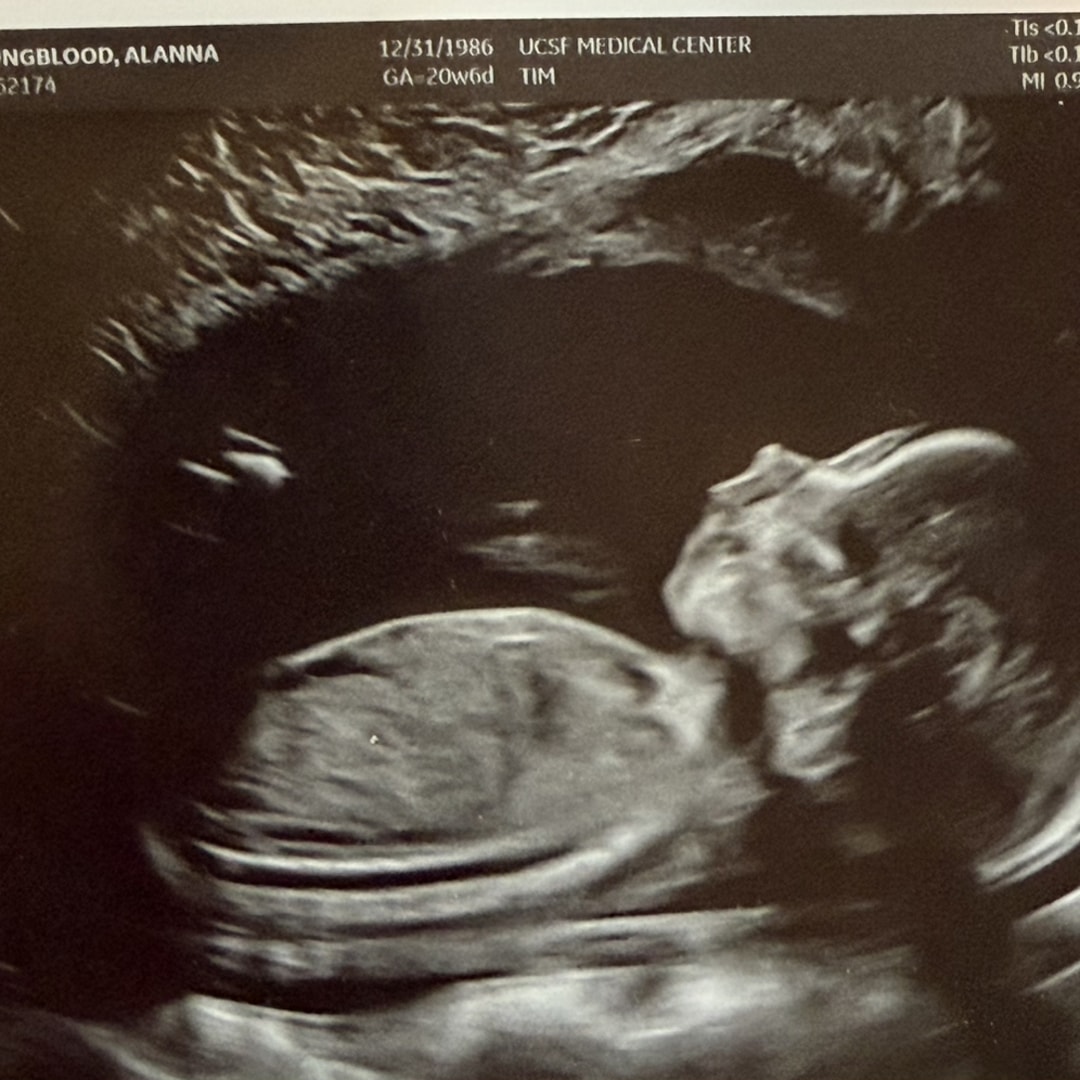 Photo shared by Alanna for their Babylist baby registry.
