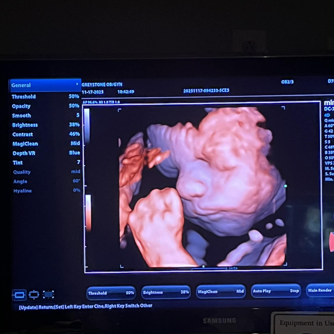 Photo shared by Hailey for their Babylist baby registry.