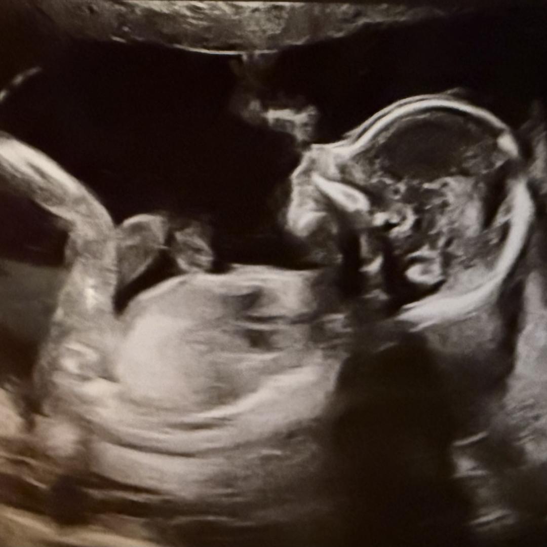 Photo shared by Lauren for their Babylist baby registry.