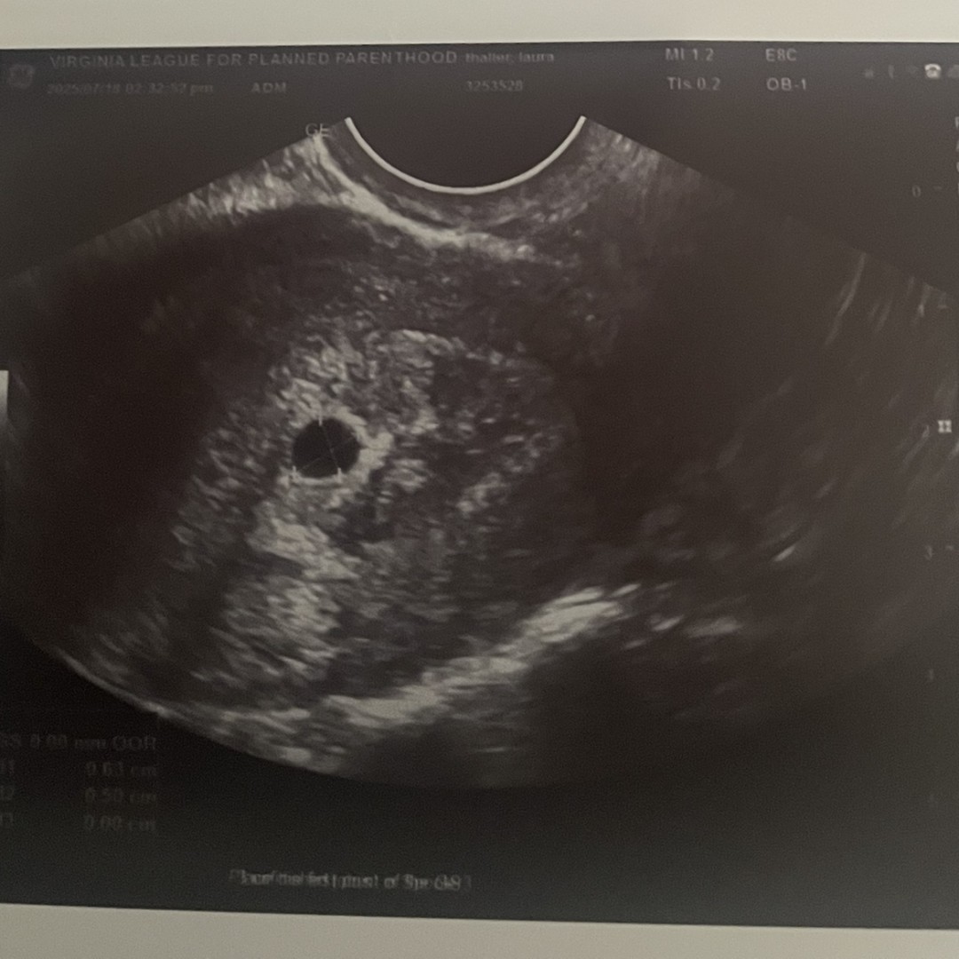 Photo shared by Laura for their Babylist baby registry.