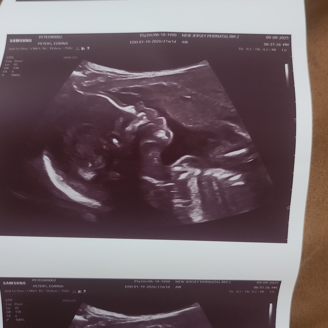 Photo shared by Jimmel & Edrina for their Babylist baby registry.